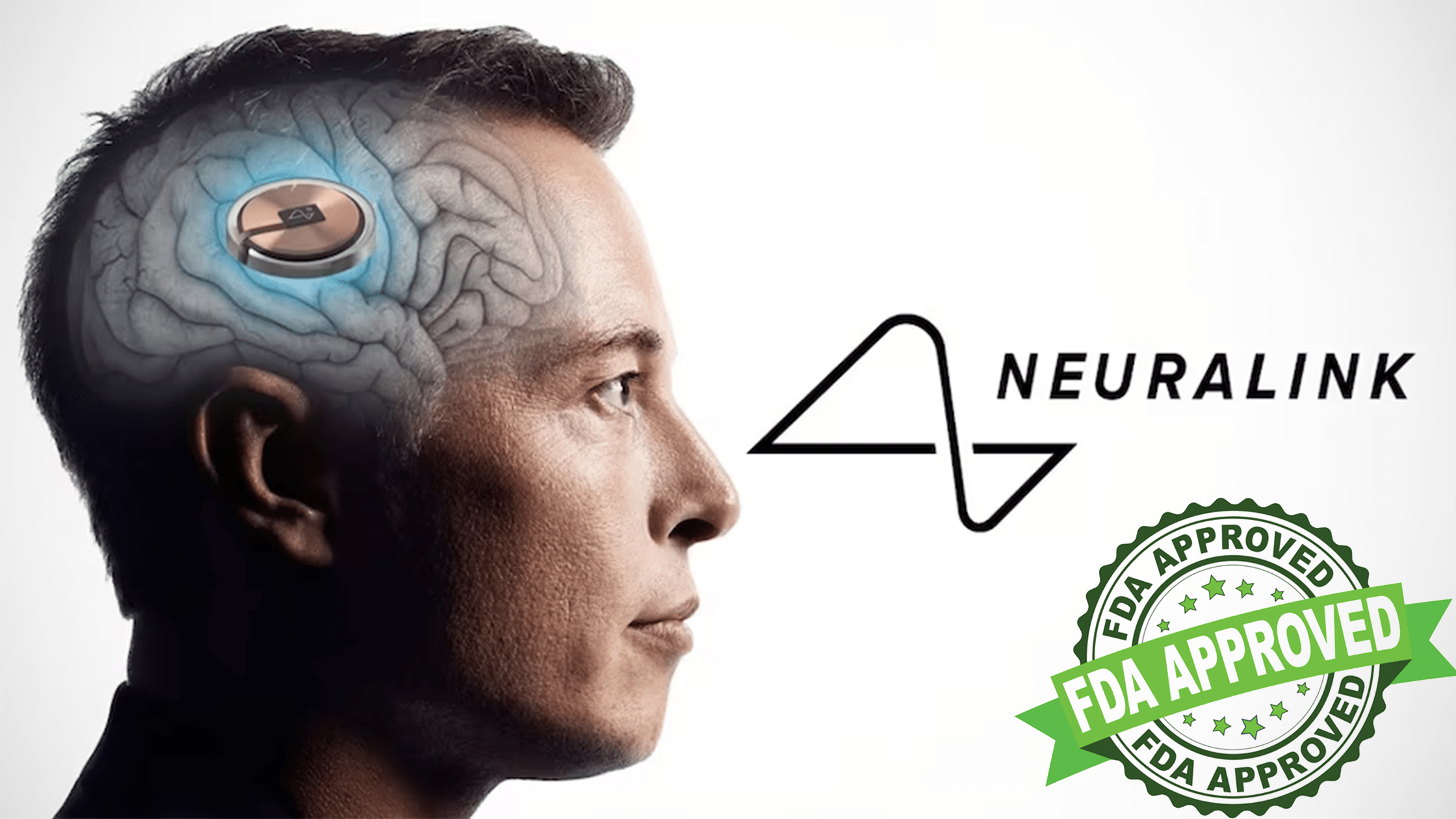 Neuralink di Elon Musk con sigillo d'approvazione FDA