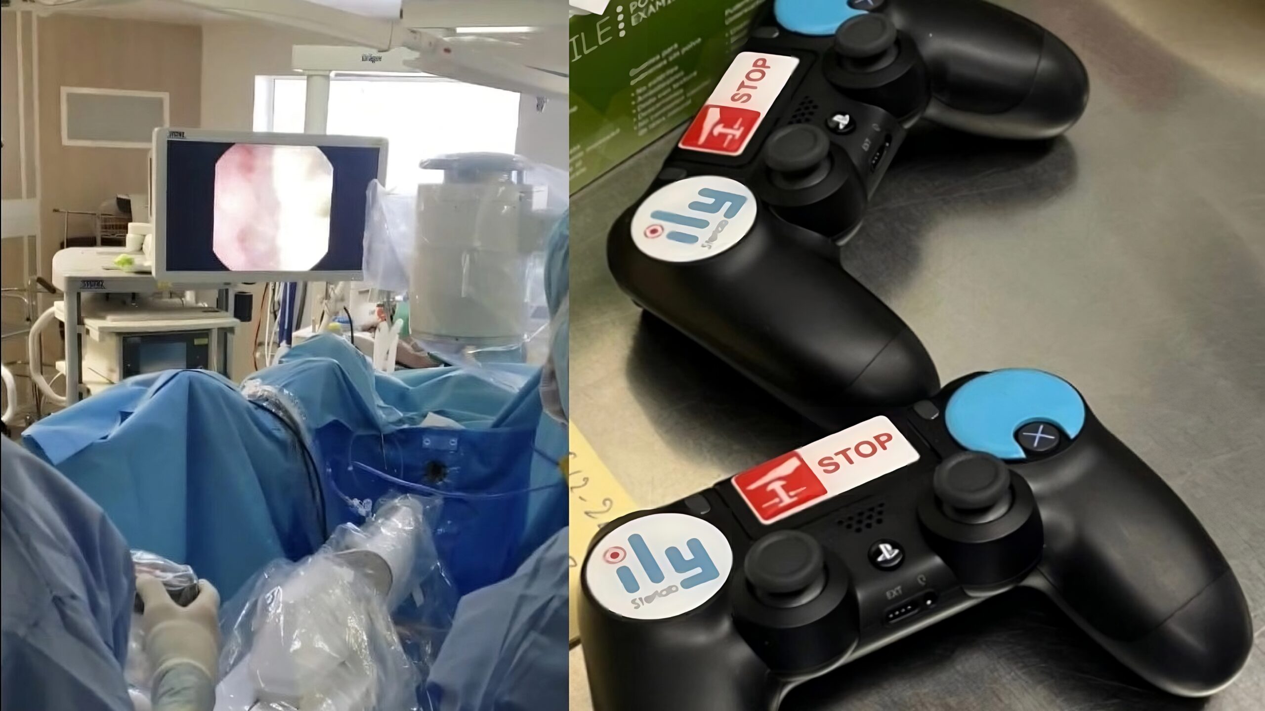 Playstation: DualShock e robot Ily sono stati usati per un'operazione in endoscopia a Torino