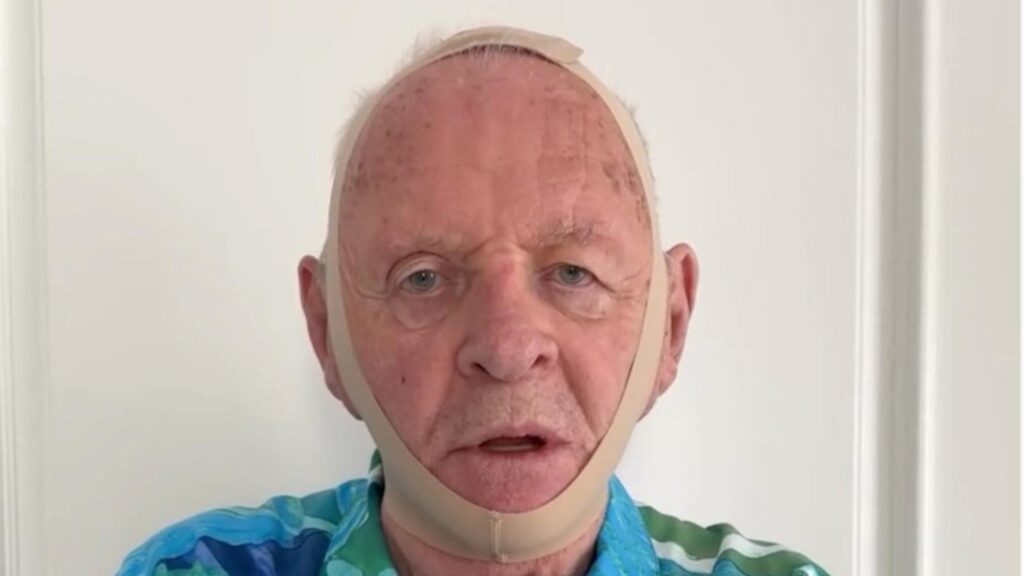 Anthony Hopkins prova la maschera da viso di Kim Kardashian e "rispolvera" il suo Hannibal Lecter 1 Anthony Hopkins